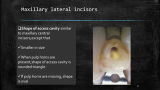 Maxillary lateral incisors
Shape of access cavity similar
to maxillary central
incisors,except that
Smaller in size
When pulp horns are
present,shape of access cavity is
rounded triangle
If pulp horns are missing, shape
is oval
37
 