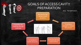 GOALS OF ACCESS CAVITY
PREPARATION
Removal of all
carious tooth
structure
To achieve
straight or direct
line access
To locate all root
canal orifices
To conserve
tooth structure
Complete de-
roofing of pulp
chamber
ACC. TOVERTUCCI
4
 