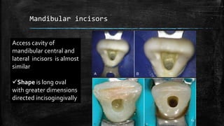 Mandibular incisors
Access cavity of
mandibular central and
lateral incisors is almost
similar
Shape is long oval
with greater dimensions
directed incisogingivally
54
 