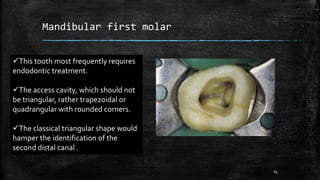 Mandibular first molar
This tooth most frequently requires
endodontic treatment.
The access cavity, which should not
be triangular, rather trapezoidal or
quadrangular with rounded corners.
The classical triangular shape would
hamper the identification of the
second distal canal .
65
 