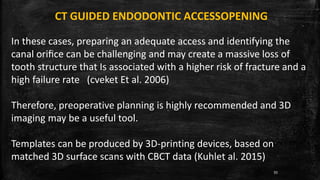 CT GUIDED ENDODONTIC ACCESSOPENING
In these cases, preparing an adequate access and identifying the
canal oriﬁce can be challenging and may create a massive loss of
tooth structure that Is associated with a higher risk of fracture and a
high failure rate (cveket Et al. 2006)
Therefore, preoperative planning is highly recommended and 3D
imaging may be a useful tool.
Templates can be produced by 3D-printing devices, based on
matched 3D surface scans with CBCT data (Kuhlet al. 2015)
93
 