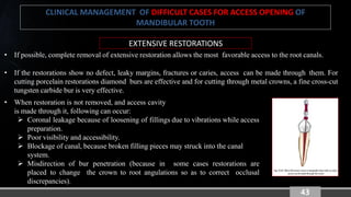 Principles of Endodontic Access Cavity Preparation: Mandibular Teeth | PDF