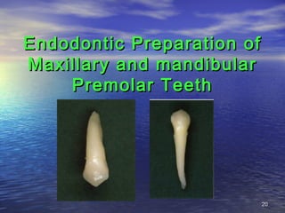 Endodontic Preparation of
Maxillary and mandibular
    Premolar Teeth




                            20
 