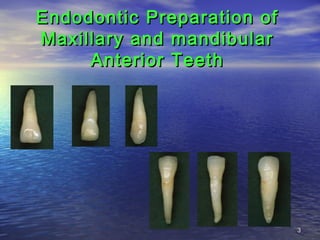 Endodontic Preparation of
Maxillary and mandibular
     Anterior Teeth




                            3
 