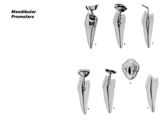 Mandibular
Premolars

 
