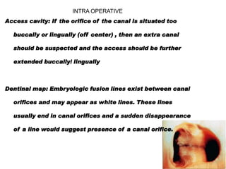 INTRA OPERATIVE
Access cavity: If the orifice of the canal is situated too
buccally or lingually (off center) , then an extra canal
should be suspected and the access should be further
extended buccally/ lingually

Dentinal map: Embryologic fusion lines exist between canal
orifices and may appear as white lines. These lines
usually end in canal orifices and a sudden disappearance
of a line would suggest presence of a canal orifice.

 