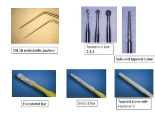 Round bur size
2,3,4
Safe-end tapered stone
DG 16 endodontic explorer
Tapered stone with
round end
Endo Z burTransmetal bur
 