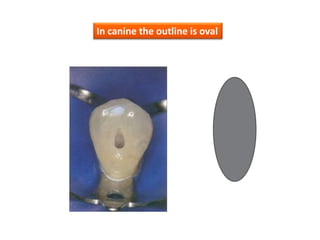 In canine the outline is oval
 