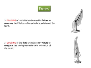 Errors
1- GOUGING of the labial wall caused by failure to
recognize the 29-degree lingual-axial angulation of the
tooth.
2- GOUGING of the distal wall caused by failure to
recognize the 16-degree mesial-axial inclination of
the tooth.
 