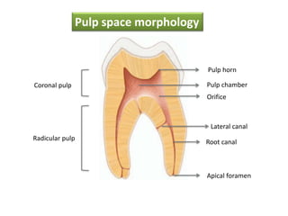 Coronal pulp
Radicular pulp
Pulp chamber
Pulp horn
Orifice
Root canal
Lateral canal
Apical foramen
Pulp space morphology
 