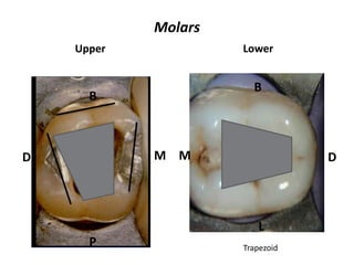 Molars
Upper Lower
Trapezoid
B
B
P
L
M MD D
 