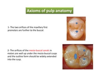 Axioms of pulp anatomy
1- The two orifices of the maxillary first
premolars are further to the buccal.
2- The orifices of the mesio-buccal canals in
molars are well up under the mesio-buccal cusps
and the outline form should be widely extended
into the cusp.
 