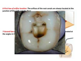 6-First law of orifice location: The orifices of the root canals are always located at the
junction of the walls and the floor.
7-Second law of orifice location: The orifices of the root canals are always located at
the angles in the floor–wall junction.
 