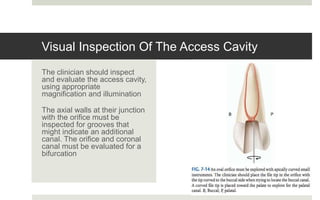 Access cavity preparation | PPTX