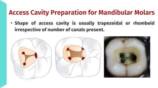 Principles of Access cavity preparation.pptx