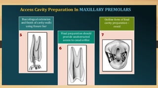 Access Cavity Preparation of anterior and posterior teeth | PPTX