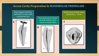 Access Cavity Preparation of anterior and posterior teeth | PPTX