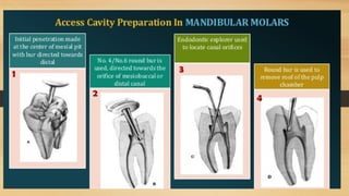Access Cavity Preparation of anterior and posterior teeth | PPTX