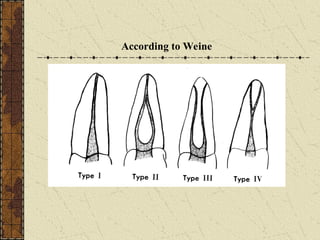 ACCESS CAVITY PREPARATION IN ENDODONTICS-Narayan.ppt