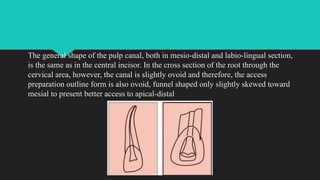 ACCESS CAVITY PREPARATION (1)-CHARUKAPUR27.pptx