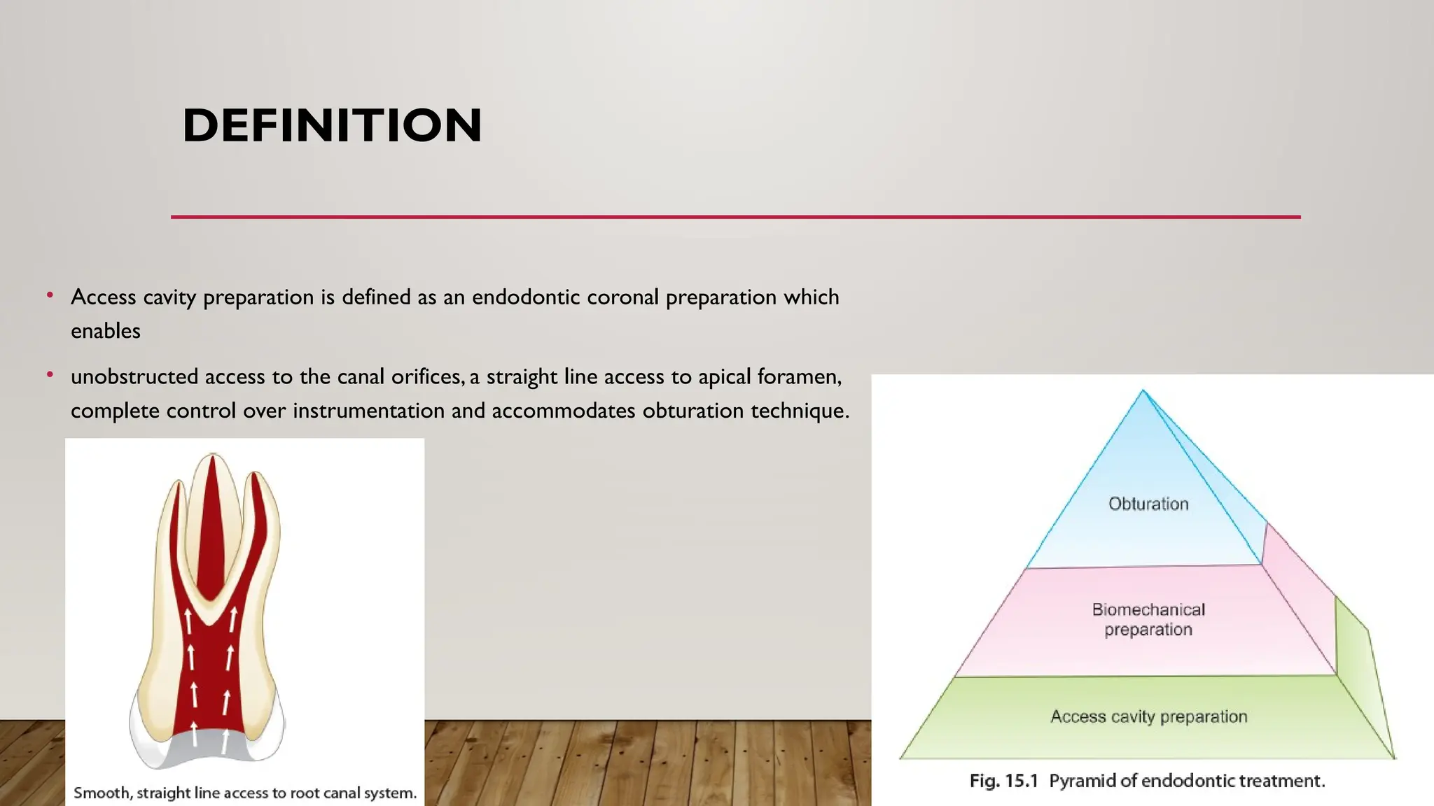 Access Cavity Preparation (2).pptxin endodontic | PPT