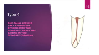 Type 4
ONE CANAL LEAVING
THE CHAMBER BUT
DIVIDING INTO TWO
SEPARATE CANALS AND
EXITING IN TWO
SEPARATE FORAMINA
15
 