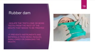 Rubber dam
• ISOLATE THE TEETH (ONE OR MORE
TEETH) FROM THE REST OF THE
MOUTH THAT NEEDS TO BE TREATED
•IT PREVENTS INSTRUMENTS AND
MATERIALS FROM BEING INHALED,
SWALLOWED OR DAMAGING THE
MOUTH.
19
 