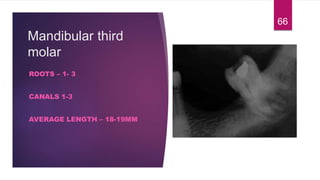 Mandibular third
molar
ROOTS – 1- 3
CANALS 1-3
AVERAGE LENGTH – 18-19MM
66
 