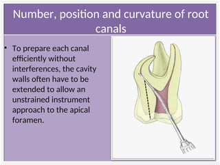 access cavity preparation and design features | PPT