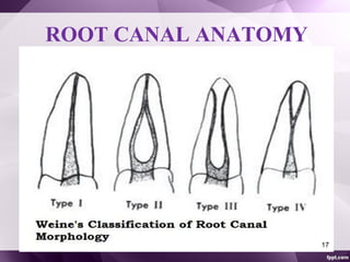 Weine Classification Access cavity preparation posteriors | PPT
