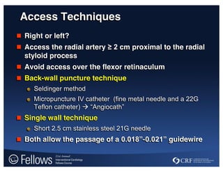 Access Techniques
 Right or left?
 Access the radial artery ≥  2  cm proximal to the radial
styloid process
 Avoid access over the flexor retinaculum
 Back-wall puncture technique
Seldinger method
Micropuncture IV catheter (fine metal needle and a 22G
Teflon catheter)  “Angiocath”
 Single wall technique
Short 2.5 cm stainless steel 21G needle
 Both allow the passage of a 0.018”-0.021”  guidewire
 