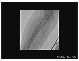 Courtesy – Tejas Patel
 