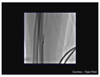 Courtesy – Tejas Patel
 