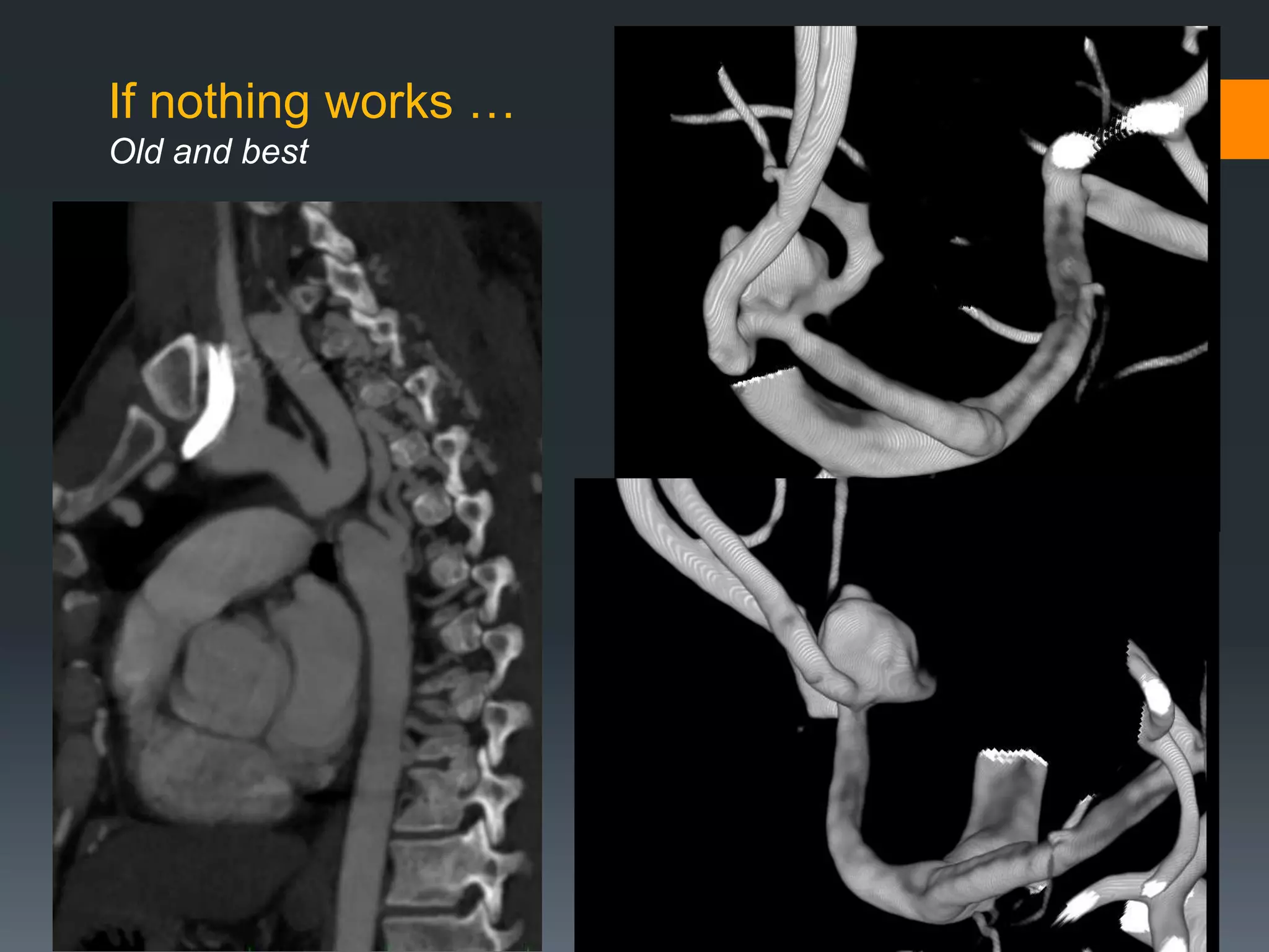 If nothing works …
Old and best
 