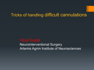 Tricks of handling difficult cannulations
Vipul Gupta
Neurointerventional Surgery
Artemis Agrim Institute of Neurosciences
 