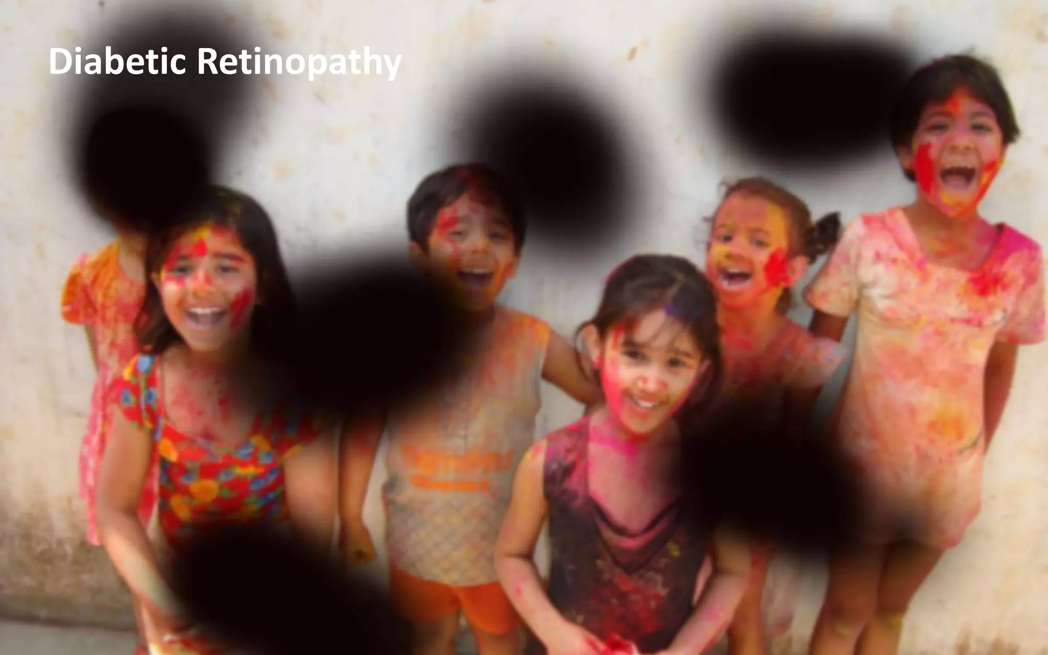 Diabetic Retinopathy
 