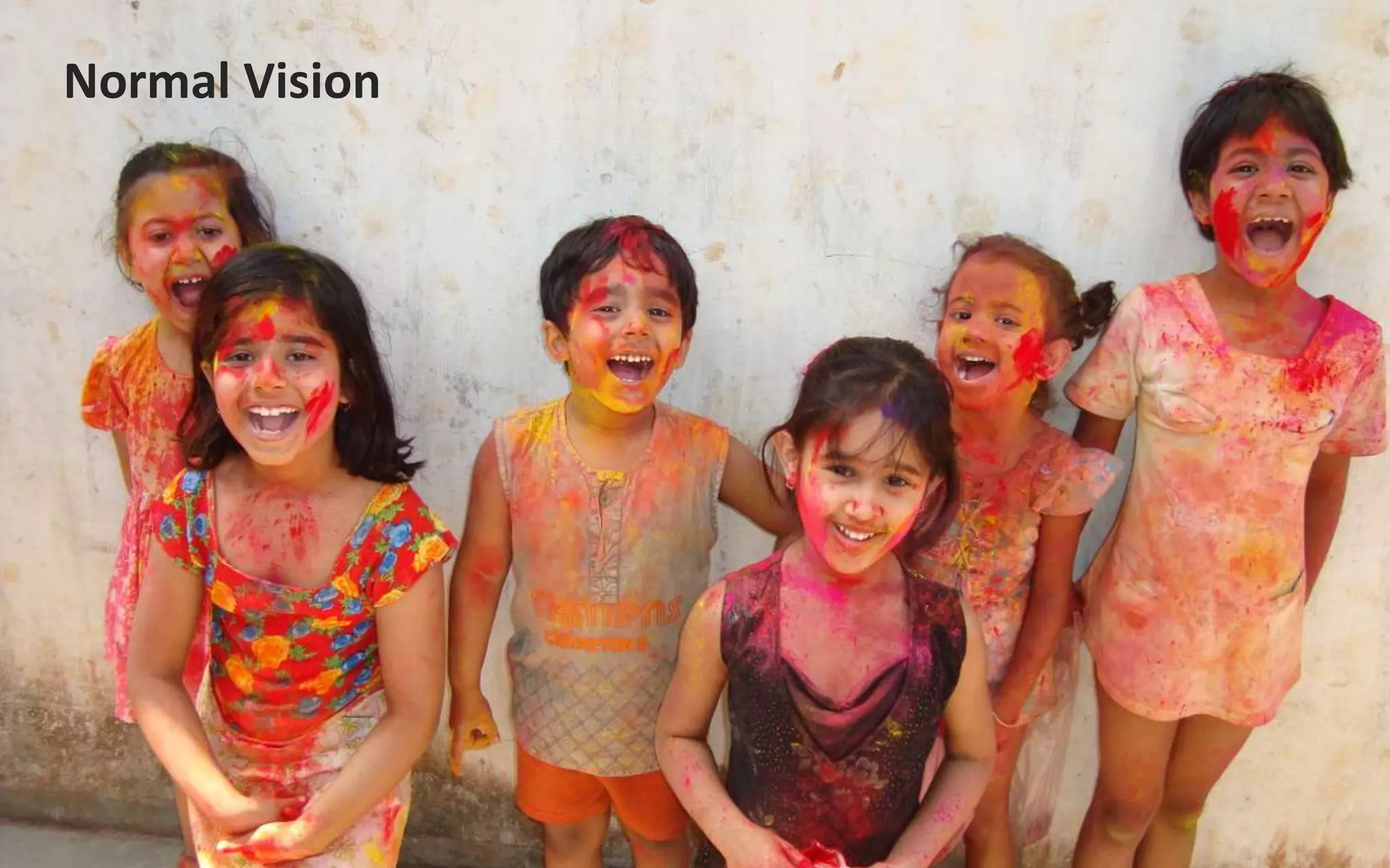 Normal Vision
 