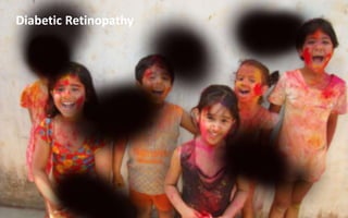 Diabetic Retinopathy
 