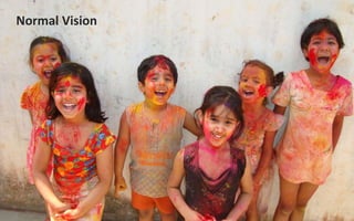 Normal Vision
 