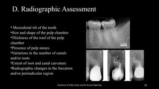 Pulpstone Radiograph access opening & anatomy of root canalss | PPTX