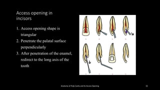 access opening & anatomy of root canalss | PPTX