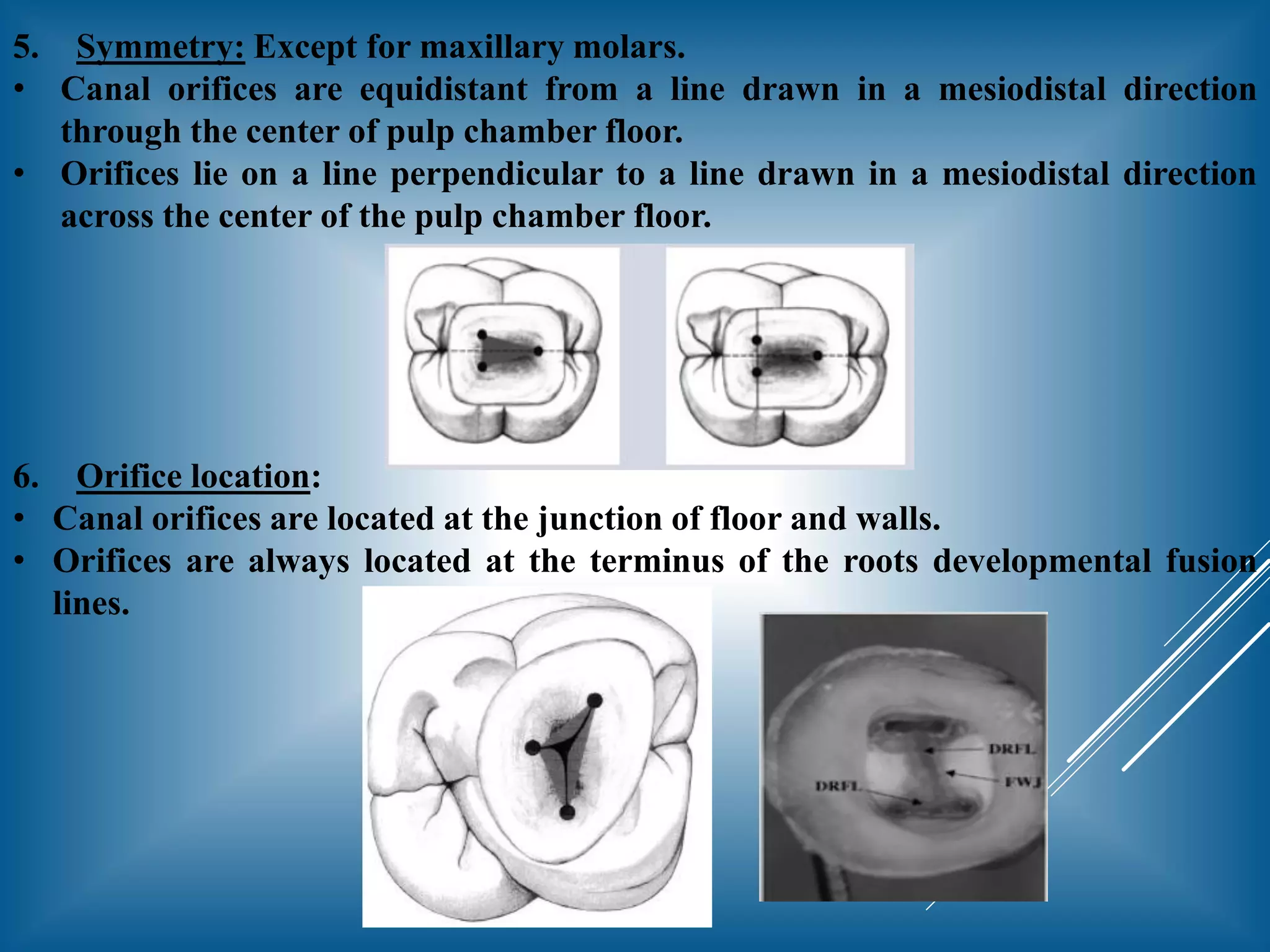 Access opening of molar teeth | PDF
