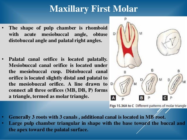 Access Opening Of Molar Teeth Access Opening Of Molar Teeth