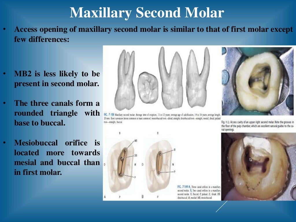 Access opening of molar teeth