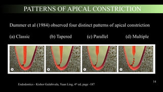Apical Pattern ACCESS OPENING PPT.pptx working length wl | PPTX