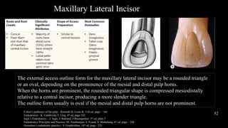 Slender Triangle ACCESS OPENING PPT.pptx working length wl | PPTX