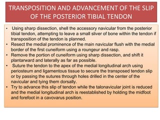 TRANSPOSITION AND ADVANCEMENT OF THE SLIP
OF THE POSTERIOR TIBIAL TENDON
•

•
•

•

•

Using sharp dissection, shell the accessory navicular from the posterior
tibial tendon, attempting to leave a small sliver of bone within the tendon if
transposition of the tendon is planned.
Resect the medial prominence of the main navicular flush with the medial
border of the first cuneiform using a roungeur and rasp.
Remove the portion of cuneiform using sharp dissection, and shift it
plantarward and laterally as far as possible.
Suture the tendon to the apex of the medial longitudinal arch using
periosteum and ligamentous tissue to secure the transposed tendon slip
or by passing the sutures through holes drilled in the center of the
navicular and tying them dorsally.
Try to advance this slip of tendon while the talonavicular joint is reduced
and the medial longitudinal arch is reestablished by holding the midfoot
and forefoot in a cavovarus position.

 