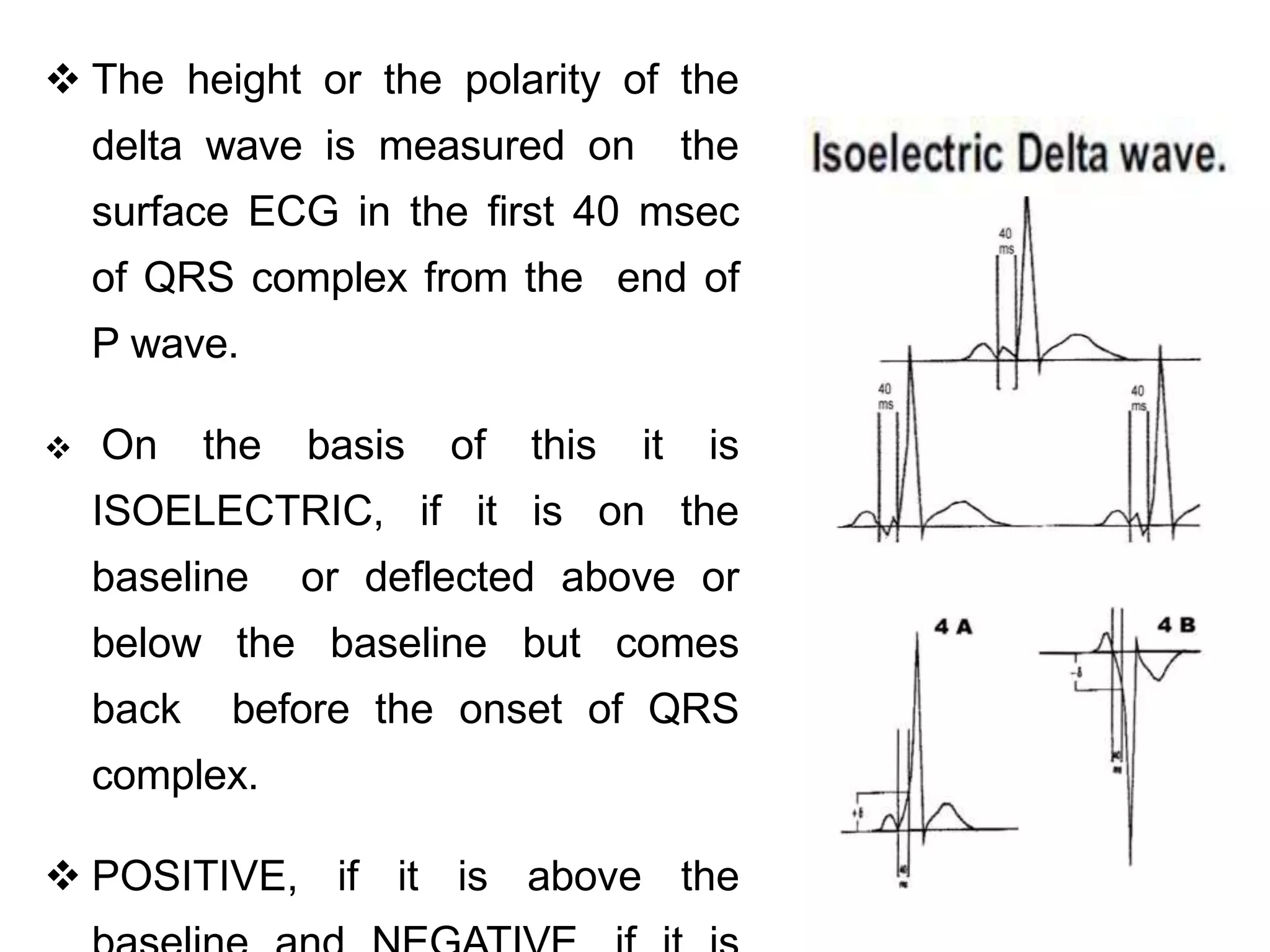  The height or the polarity of the
delta wave is measured on the
surface ECG in the first 40 msec
of QRS complex from the end of
P wave.
 On the basis of this it is
ISOELECTRIC, if it is on the
baseline or deflected above or
below the baseline but comes
back before the onset of QRS
complex.
 POSITIVE, if it is above the
 