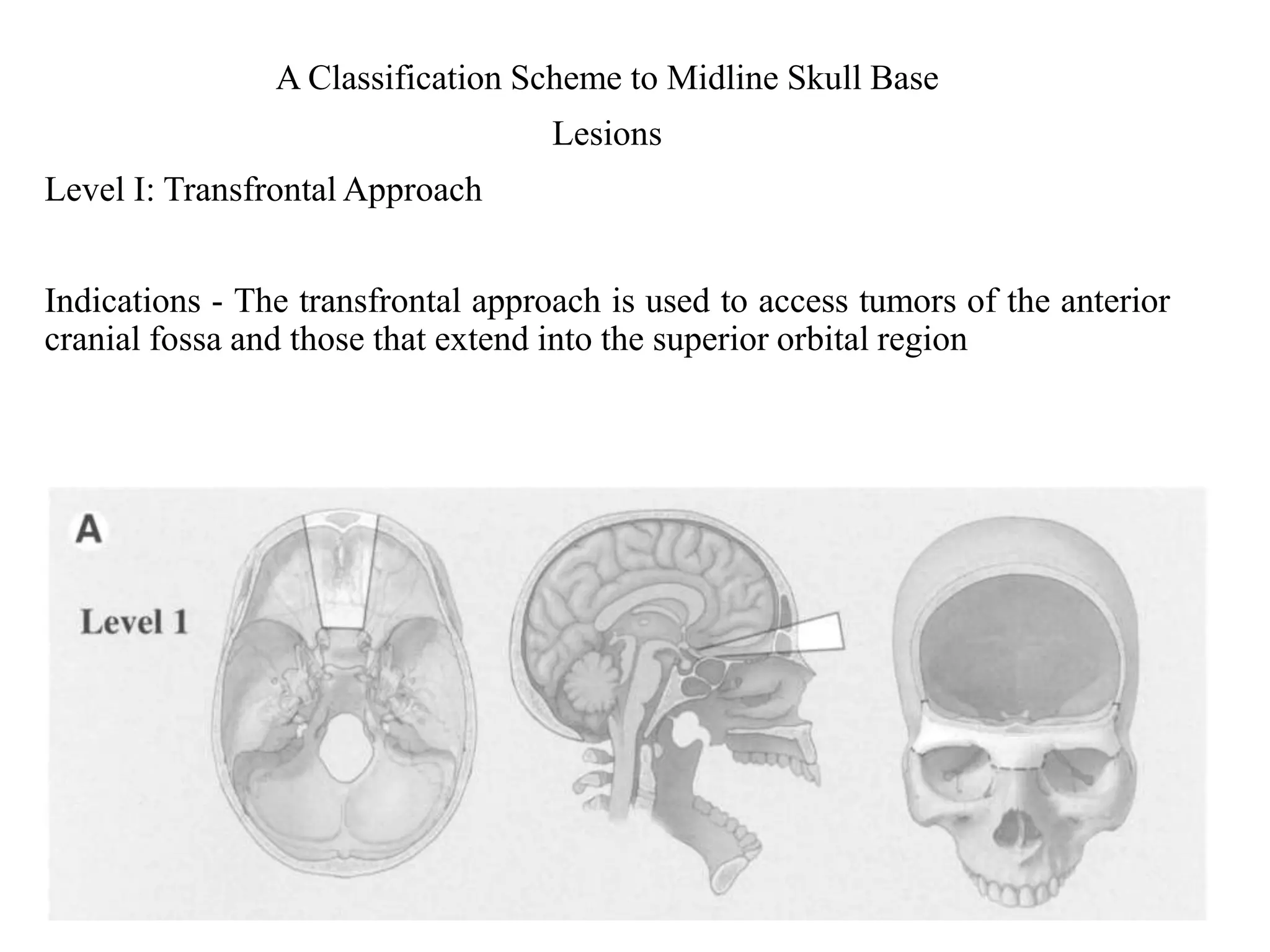 Access osteotomies in oral & cranio-maxillofacial surgery | PPTX