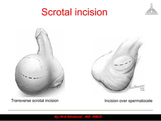 Testopel Incision Site Access to urinary system v2 | PDF